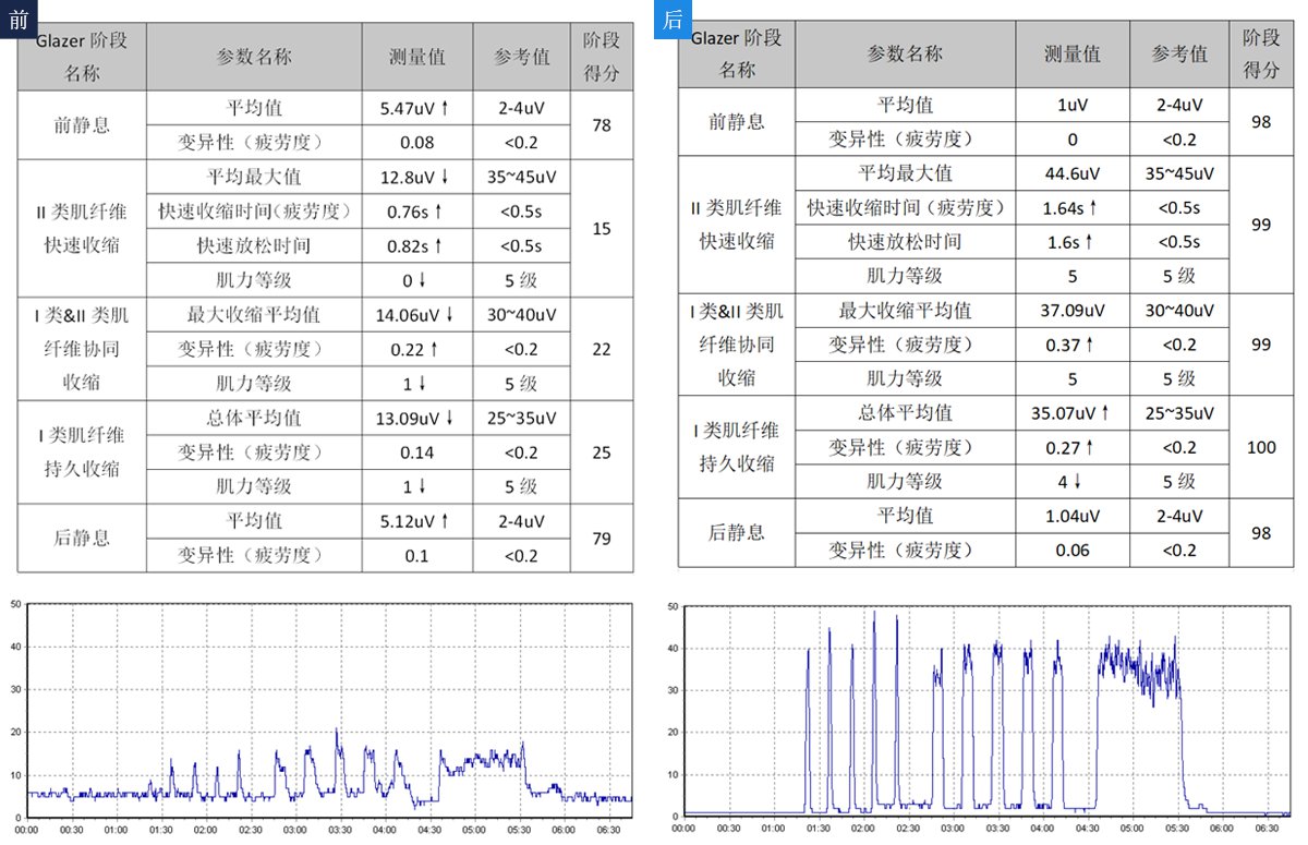 盆底功能评估报告,治疗前后对比